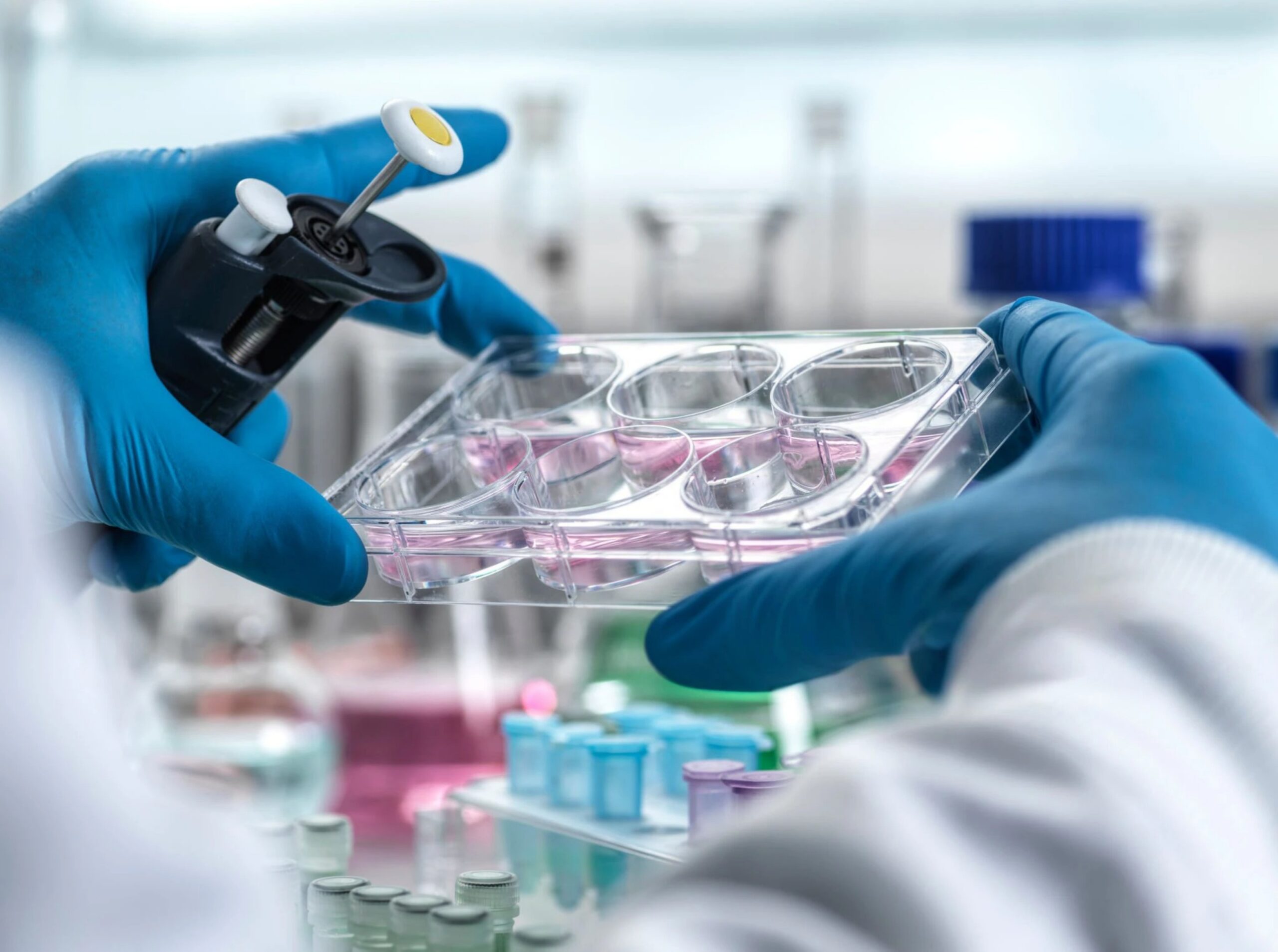 A lab technician wearing blue gloves holds a multi-well plate containing cell cultures, showcasing a science or medical experiment in a laboratory setting.