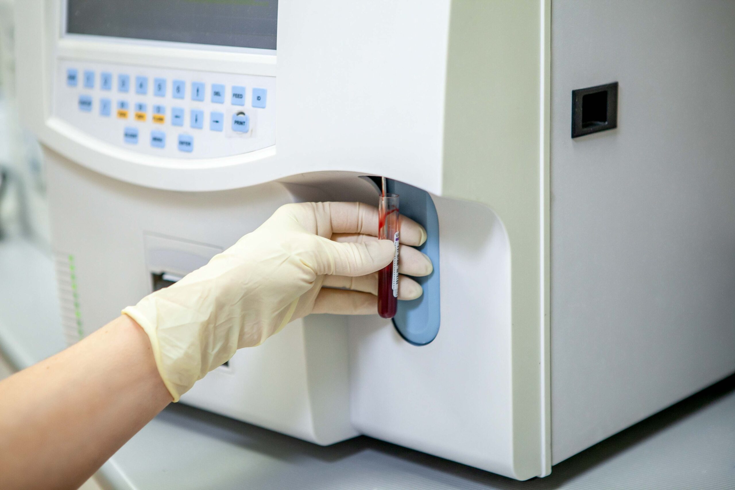 Laboratory technician performing flow cytometry analysis with blood samples.